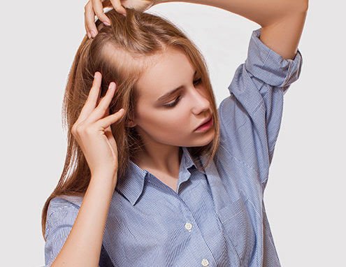 Caída de cabello posparto: causas y recuperación