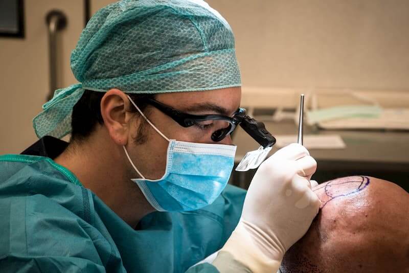 Microinjerto en el Centro Médico Teknon
