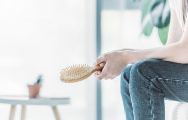 Otras alopecias