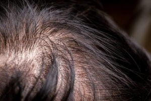 pelo