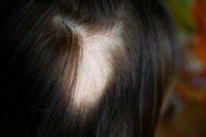 arrancarse el pelo