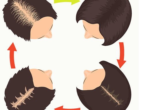 niveles alopecia femenina