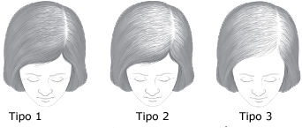 caida del pelo mujer