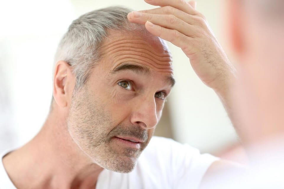 Tipos de implantación de cabello