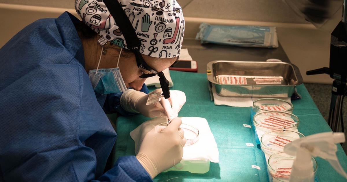 Técnica FUE en Barcelona