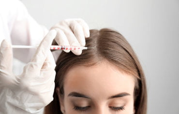 Tratamiento de Mesoterapia Capilar en Barcelona