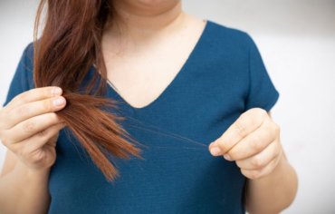 ¿Existe cura para la tricotilomanía?