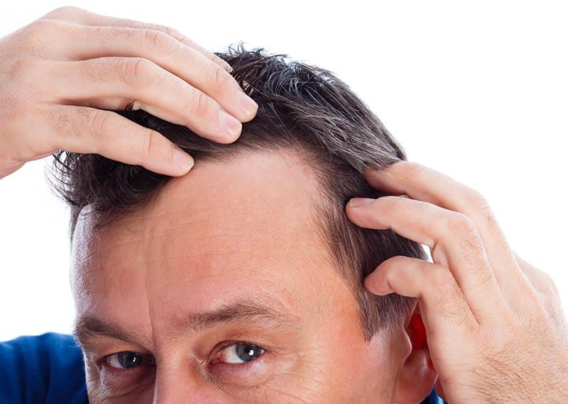 Deshazte del daño causado en tu cabello por el estrés, malos patrones de sueño y el alcohol