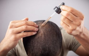 ¿Hay que lavarse el pelo después de usar minoxidil?
