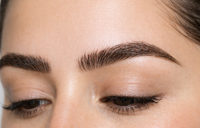 Microinjerto de cejas para mujer en Barcelona: resultados naturales y duraderos