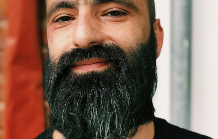 En otras partes del cuerpo: cejas, barba, pubis