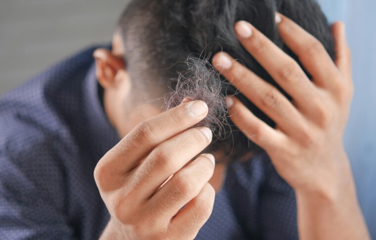 Hábitos que dañan tu cabello: toma medidas